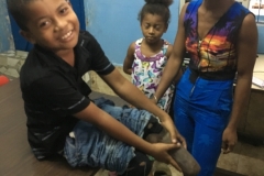 Joycka, amputé de ses 2 jambes, a pu etre appareillé grâce à un parrainage